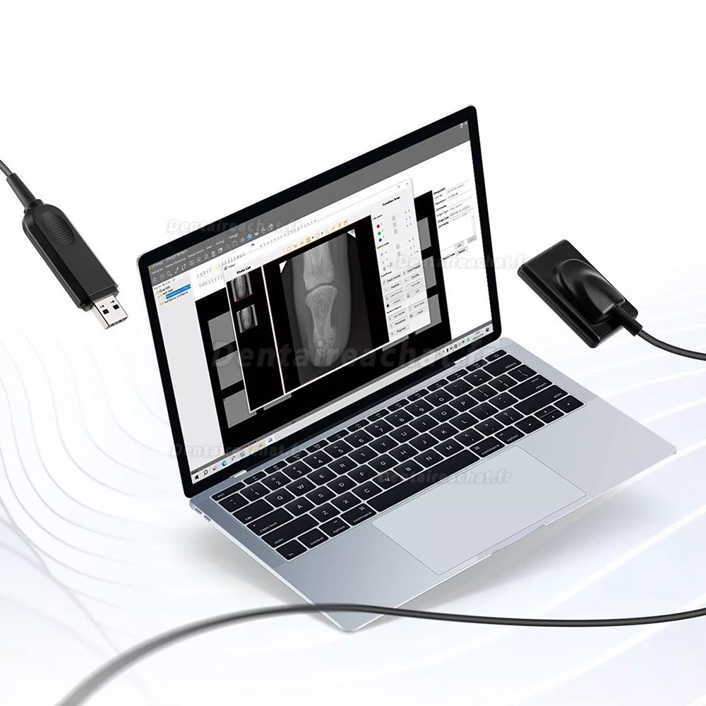 Appareil de radiographie dentaire portatif + capteur de radiographie dentaire 2230/2635